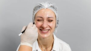 botox-visage